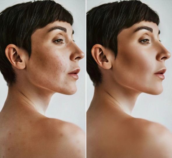 Model Photo retouching service