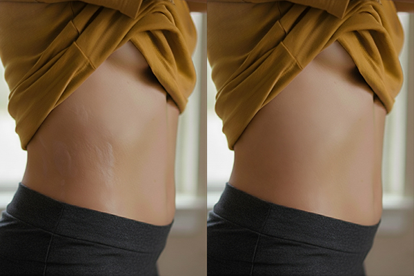 skin texture editing